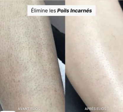 Rasoir Feminin  Multifonctionnel 5-en-1 Elios